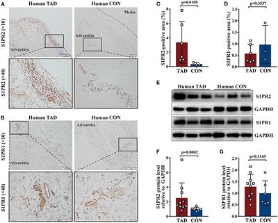Inhibition of Sphingosine-1-Phosphate Receptor 2 Prevents Thoracic Aortic Dissection and Rupture